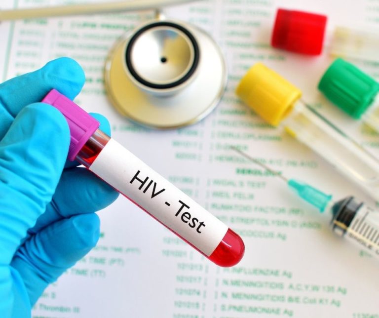 เอชไอวี (HIV) และการตรวจหาเชื้อ